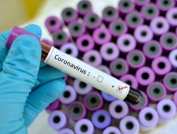 prueba coronavirus laboratorio